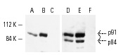 Western blot analysis of Stat1α p91 and Stat1β p84 expression in nuclear extracts of phorbol ester-treated HeLa (A,D), A-431 (B,E) and K-562 (C,F) cells. Antibodies include Stat1α p91 (C-24): sc-345 (AC) and Stat1 p84/p91 (E-23): sc-346 (DF).
