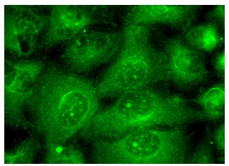 Stat1 p84/p91 (E-23): sc-346. Immunofluorescence staining of methanol-fixed HeLa cells showing cytoplasmic and nuclear localization.
