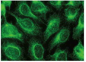 GADD 34 (S-20): sc-824. Immunofluorescence staining of methanol-fixed HeLa cells showing cytoplasmic localization.