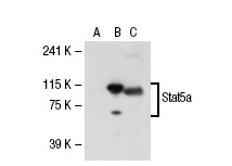 Stat5 (C-17): sc-835. Western blot analysis of Stat5a expression in non-transfected 293T: sc-117752 (A), human Stat5a transfected 293T: sc-114013 (B) and K-562 (C) whole cell lysates.