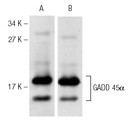  Western blot analysis of COS cells transfected with GADD 45α (A,B). Antibodies tested include GADD 45α (C-20): sc-792 (A) and GADD 45α (H-165): sc-797 (B).