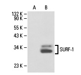 SURF-1 (K-19): sc-55905. Western blot analysis of SURF-1 expression in non-transfected: sc-110760 (A) and human SURF-1 transfected: sc-110725 (B) 293 whole cell lysates.