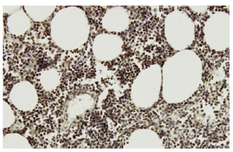 TAF II p55 (SQ-8): sc-101167. Immunoperoxidase staining of formalin-fixed, paraffin-embedded human placenta tissue showing nuclear localization.