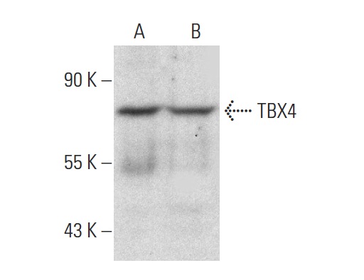 TBX4 (L-20): sc-17882. Western blot analysis of TBX4 expression in HeLa (A) and Hep G2 (B) whole cell lysates.