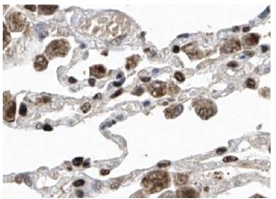 TBX4 (L-20): sc-17882. Immunoperoxidase staining of formalin fixed, paraffin-embedded human lung tissue showing nuclear and cytoplasmic staining of macro-phages at high magnification. Kindly provided by The Swedish Human Protein Atlas (HPA) program.