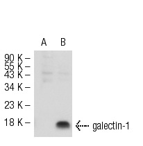 galectin-1 (H-45): sc-28248. Western blot analysis of galectin-1 expression in non-transfected: sc-117752 (A) and mouse galectin-1 transfected: sc-120390 (B) 293T whole cell lysates.