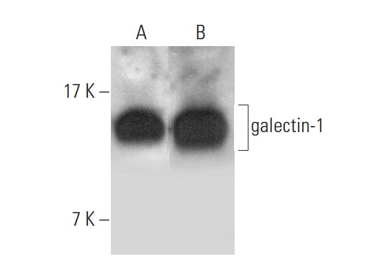 galectin-1 (H-45): sc-28248. Western blot analysis of galectin-1 expression in HL-60 (A) and NIH/3T3 (B) whole cell lysates.