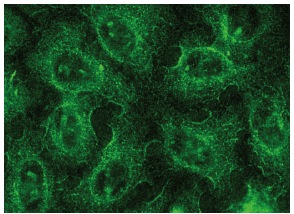 galectin-1 (H-45): sc-28248. Immunofluorescence staining of methanol-fixed HeLa cells showing cytoplasmic and membrane localization.