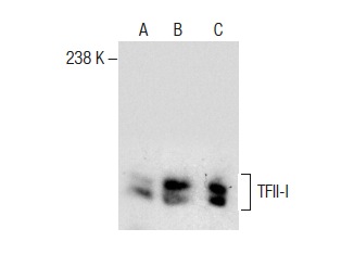 TFII-I (H-58): sc-28716. Western blot analysis of TFII-I expression in HeLa (A) and Jurkat (B) nuclear extracts and NAMALWA whole cell lysate (C).