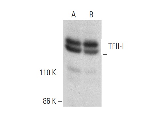 TFII-I (H-58): sc-28716. Western blot analysis of TFII-I expression in HeLa (A) and Jurkat (B) nuclear extracts.