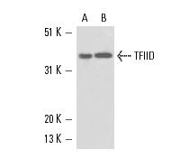 TFIID (1TB18): sc-56794. Western blot analysis of TFIID expression in F9 whole cell lysate (A) and rat testis tissue extract (B).