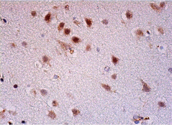 TFIID (1TB18): sc-56794. Immunoperoxidase staining of formalin fixed, paraffin-embedded human cerebral cortex tissue showing nuclear staining of neuronal cells and glial cells.
