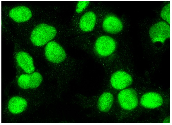 TFIIE-α (C-17): sc-237. Immunofluorescence staining of formalin-fixed HepG2 cells showing nuclear localization.