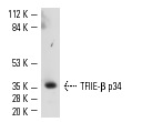 Western blot analysis of TFIIE-β recombinant protein tested at 10 ng using TFIIE-β (C-21): sc-238 at a dilution of 1:10,000.