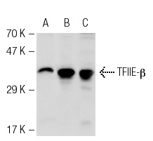 TFIIE-β (C-21): sc-238. Western blot analysis of TFIIE-β expression in non-transfected 293T: sc-117752 (A), mouse TFIIE-β transfected 293T: sc-124003 (B) and HL-60 (C) whole cell lysates.