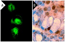 galectin-3 (H-160): sc-20157. Immunofluorescence staining of methanol-fixed RAW 264.7 cells (A) and immunoperoxidase staining of formalin fixed, paraffin-embedded mouse colon tissue (B) showing nuclear and cytoplasmic localization.