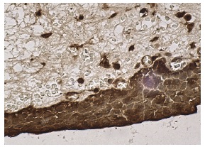 galectin-3 (H-160): sc-20157. Immunoperoxidase staining of formalin fixed, paraffin-embedded human urinary bladder tissue showing nuclear and cytoplasmic staining of urothelial cells.