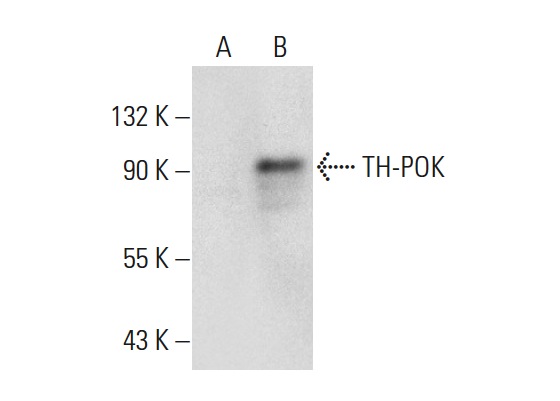 TH-POK (A-4): sc-376250. Western blot analysis of TH-POK expression in non-transfected: sc-117752 (A) and human TH-POK transfected: sc-369741 (B) 293T whole cell lysates.