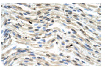 THOC3 (Z-22): sc-134087. Immunoperoxidase staining of formalin-fixed, paraffin-embedded human heart tissue showing nuclear and cytoplasmic localization.