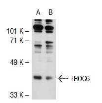 THOC6 (L-81): sc-101177. Western blot analysis of THOC6 expression in non-transfected: sc-117752 (A) and human THOC6 transfected: sc-116264 (B) 293T whole cell lysates.