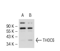 THOC6 (L-81): sc-101177. Western blot analysis of THOC6 expression in non-transfected: sc-117752 (A) and human THOC6 transfected: sc-116264 (B) 293T whole cell lysates.