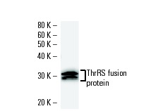 ZnT-9 (919C1a): sc-81118 Western Blot analysis of human recombinant ZnT-9 fusion protein.
