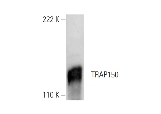 TRAP150 (H-300): sc-48779. Western blot analysis of TRAP150 expression in HeLa nuclear extract.