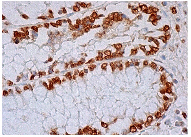 TLE (C-19): sc-13373. Immunoperoxidase staining of formalin fixed, paraffin-embedded human colon tissue showing nuclear staining of glandular cells.