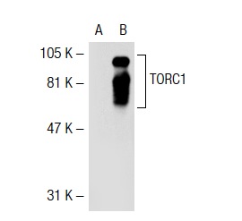 TORC1 (L-12): sc-46269. Western blot analysis of TORC1 expression in non-transfected: sc-117752 (A) and human TORC1 transfected: sc-114714 (B) 293T whole cell lysates.