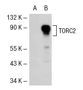 TORC2 (A-20): sc-46272. Western blot analysis of TORC2 expression in non-transfected: sc-117752 (A) and human TORC2 transfected: sc-116557 (B) 293T whole cell lysates.