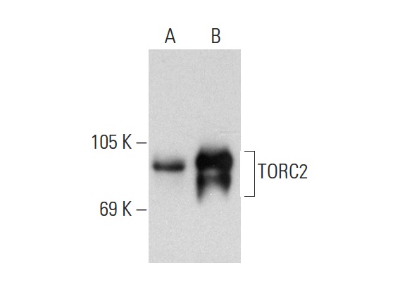 TORC2 (G-4): sc-166445. Western blot analysis of TORC2 expression in non-transfected: sc-117752 (A) and human TORC2 transfected: sc-116557 (B) 293T whole cell lysates.