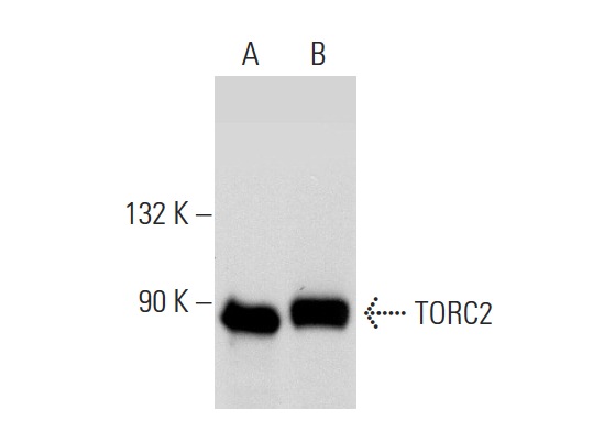 TORC2 (G-4): sc-166445. Western blot analysis of TORC2 expression in Jurkat nuclear extract (A) and JAR whole cell lysate (B).