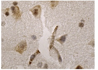 TORC2 (H-210): sc-67147. Immunoperoxidase staining of formalin fixed, paraffin-embedded human brain tissue showing nuclear and cytoplasmic staining of neuronal and glial cells.