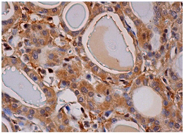 TORC2 (H-210): sc-67147. Immunoperoxidase staining of formalin fixed, paraffin-embedded human thyroid gland tissue showing cytoplasmic staining of glandular cells.