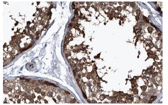 TRAX (FL-290): sc-98554. Immunoperoxidase staining of formalin fixed, paraffin-embedded human testis showing cytoplasmic staining of cells in seminiferus ducts & Leydig cells at high magnification. Kindly provided by The Swedish Human Protein Atlas (HPA) program.