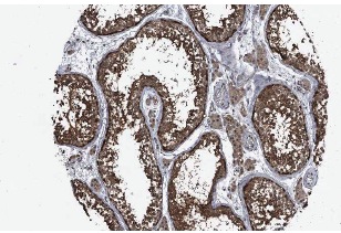 TRAX (FL-290): sc-98554. Immunoperoxidase staining of formalin fixed, paraffin-embedded human testis showing cytoplasmic staining of cells in seminiferus ducts & Leydig cells at low magnification. Kindly provided by The Swedish Human Protein Atlas (HPA) program.