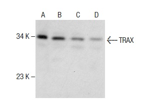 TRAX (FL-290): sc-98554. Western blot analysis of TRAX expression in Jurkat (A), HL-60 (B) and MCF7 (C) whole cell lysates and human testis tissue extract (D).