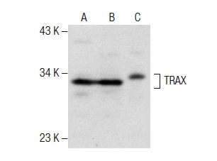 TRAX (FL-290): sc-98554. Western blot analysis of TRAX expression in Jurkat (A), HL-60 (B) and AtT-20/D16vF2 (C) whole cell lysates.