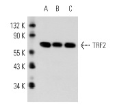 TRF2 (E-20): sc-32106. Western blot analysis of TRF2 expression in Jurkat (A) and K-562 (B) nuclear extracts and NAMALWA whole cell lysate (C).