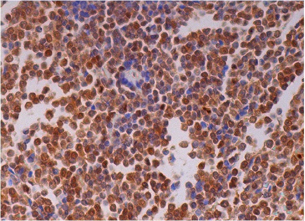 TRF2 (E-20): sc-32106. Immunoperoxidase staining of formalin fixed, paraffin-embedded human spleen tissue showing nuclear staining of cells in white pulp and cells in red pulp.