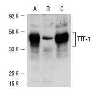 TTF-1 (H-190): sc-13040. Western blot analysis of TTF-1 expression in TT (A), A549 (B) and SHP-77 (C) whole cell lysates.