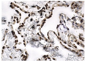 TTF-1 (H-190): sc-13040. Immunoperoxidase staining of formalin fixed, paraffin-embedded human lung tissue showing nuclear staining of pneumocytes.