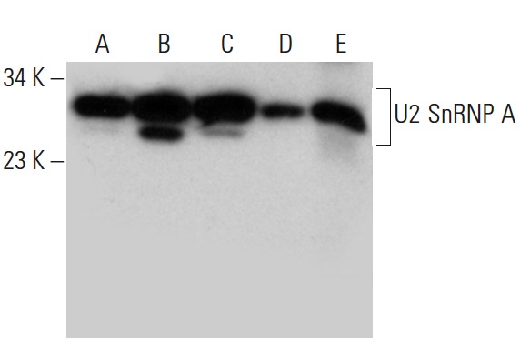 U2 SnRNP A (B-3): sc-393804. Western blot analysis of U2 SnRNP A expression in HUV-EC-C (A), Hep G2 (B) and HeLa (C) whole cell lysates and rat liver (D) and mouse liver (E) tissue extracts.