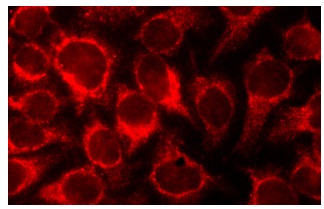 galectin-7 (F-3): sc-271472. Immunofluorescence staining of methanol-fixed HeLa cells showing cytoplasmic localization.