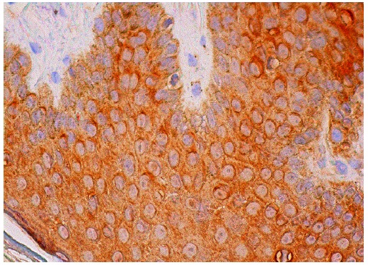 galectin-7 (F-3): sc-271472. Immunoperoxidase staining of formalin fixed, paraffin-embedded human vulva/anal skin tissue showing cytoplasmic staining of epidermal cells.
