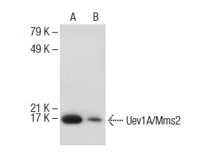 Uev1A/Mms2 (F-11): sc-377337. Western blot analysis of Uev1A/Mms2 expression in Jurkat whole cell lysate (A) and human liver tissue extract (B).