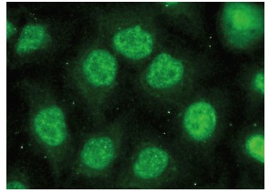 USF-1 (C-20): sc-229. Immunofluorescence staining of methanol-fixed HeLa cells showing nuclear localization.