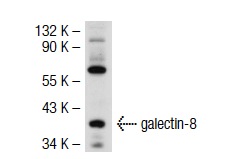 galectin-8 (H-80): sc-28254. Western blot analysis of galectin-8 expression in 293T whole cell lysate.