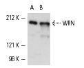 WRN (H-300): sc-5629. Western blot analysis of WRN expression in K-562 (A) and KNRK (B) nuclear extracts.