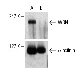 WRN siRNA (h): sc-36843. Western blot analysis of WRN expression in non-transfected control (A) and WRN siRNA transfected (B) HeLa cells. Blot probed with WRN (H-300): sc-5629. α-actinin (H-2): sc-17829 used as specificity and loading control.